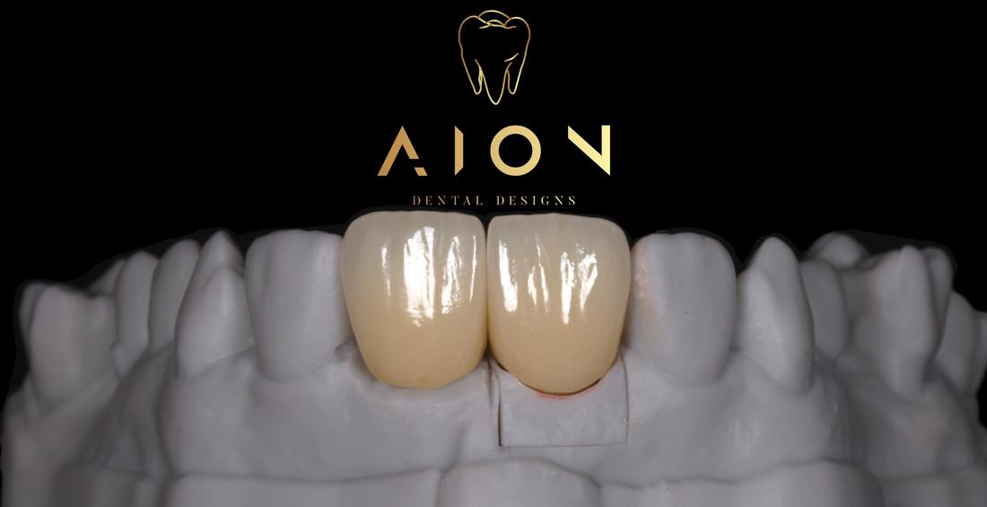 Anterior crowns