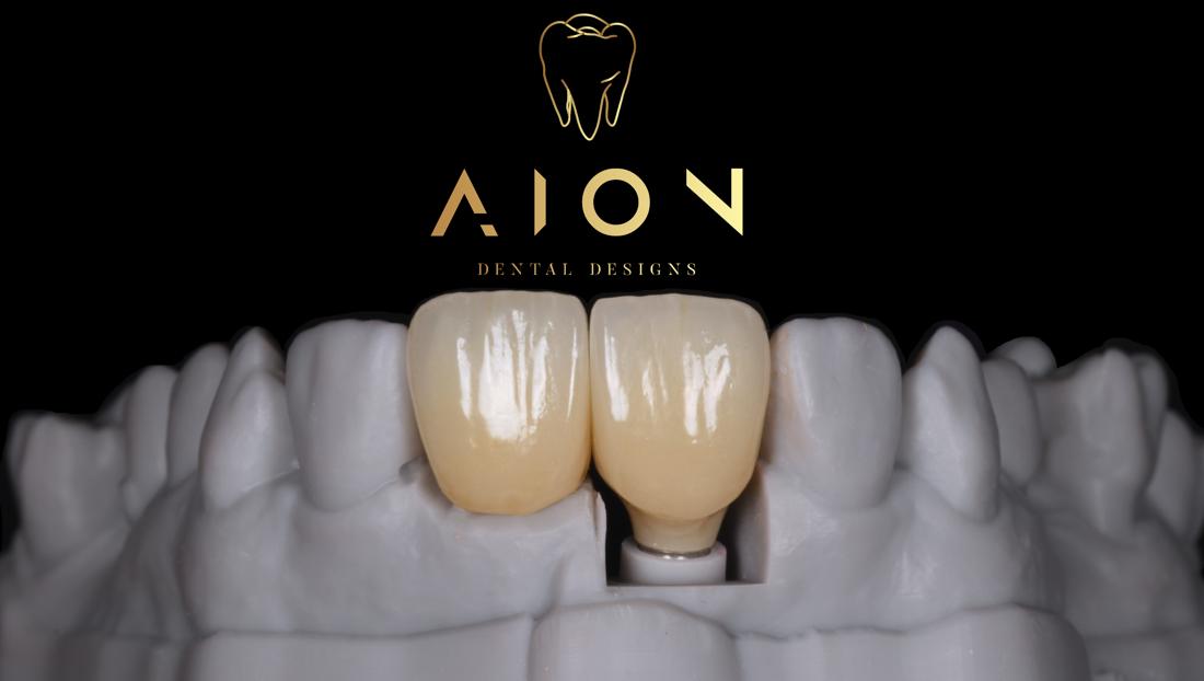 Crown and implant crown