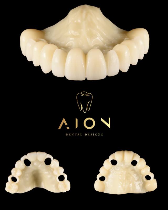 Milled temporaries for immediate loading